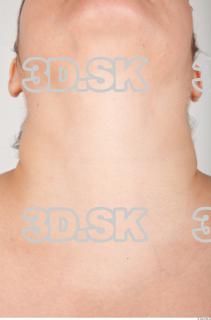 Neck texture of Betsy 0001